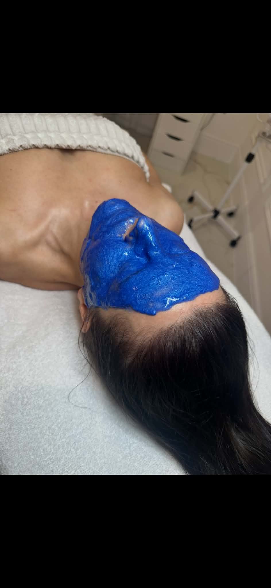 Client receiving a blue chemical mask treatment as part of a Microneedling Fusion session at Gingerbread Aesthetic