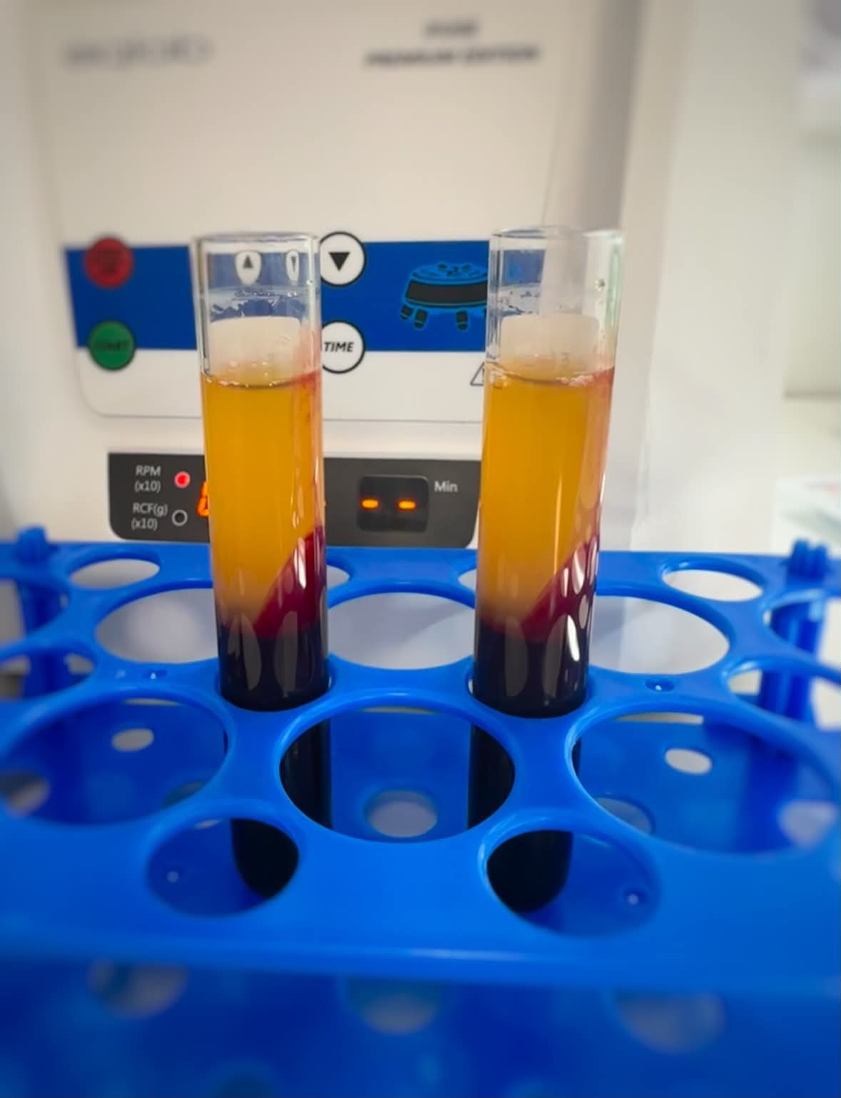 Centrifuged blood tubes showing separated Platelet Rich Plasma (PRP) — the golden plasma layer clearly visible — prepared for treatment at Gingerbread Aesthetic